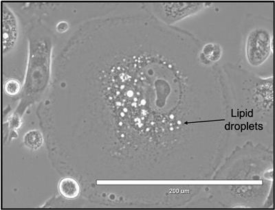 Polyaneuploid Cancer Cell Dormancy: Lessons From Evolutionary Phyla